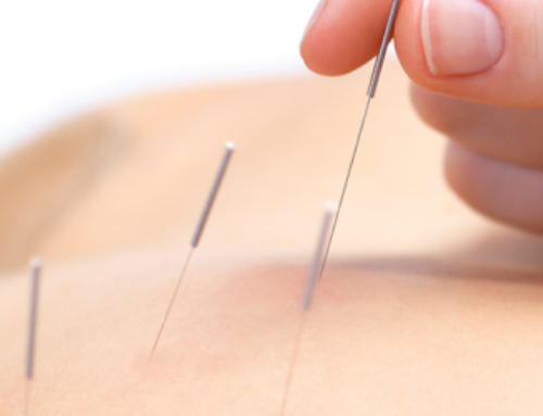 After breast cancer, acupuncture is effective at treating hot flushes